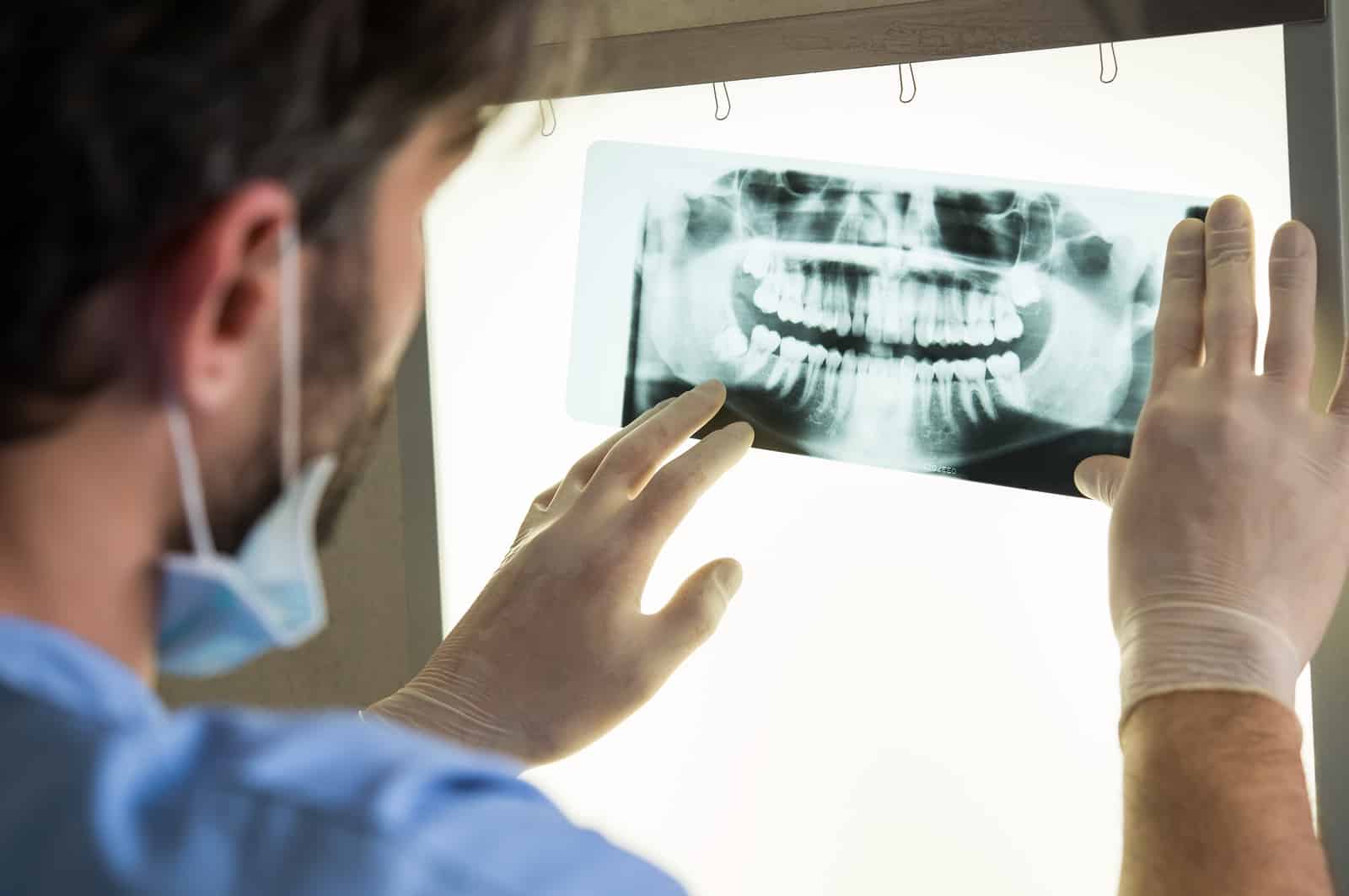 Dental-X-Ray Dental-X-Ray