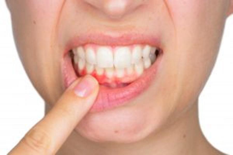 Gum disease treatment Gum disease treatment